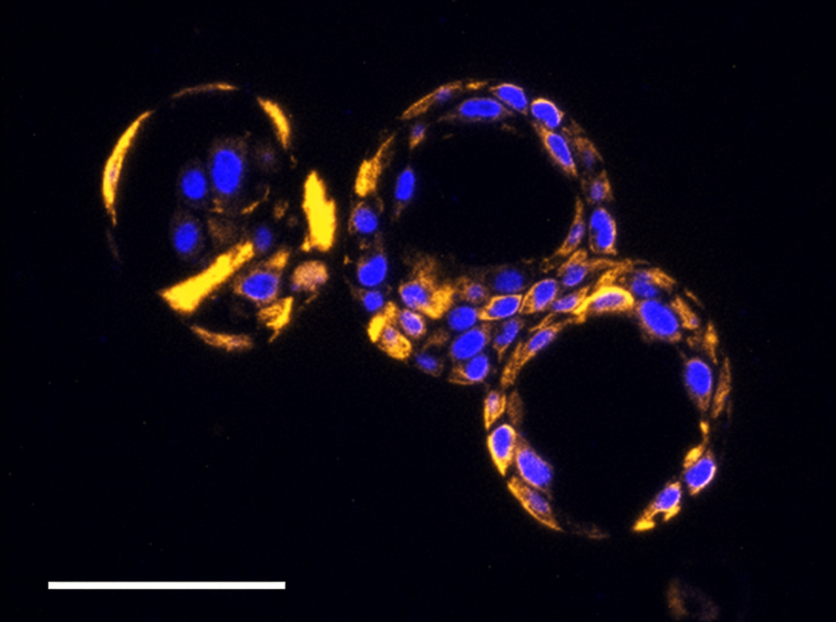 High res Cervical Organoid with KRT14 Stain