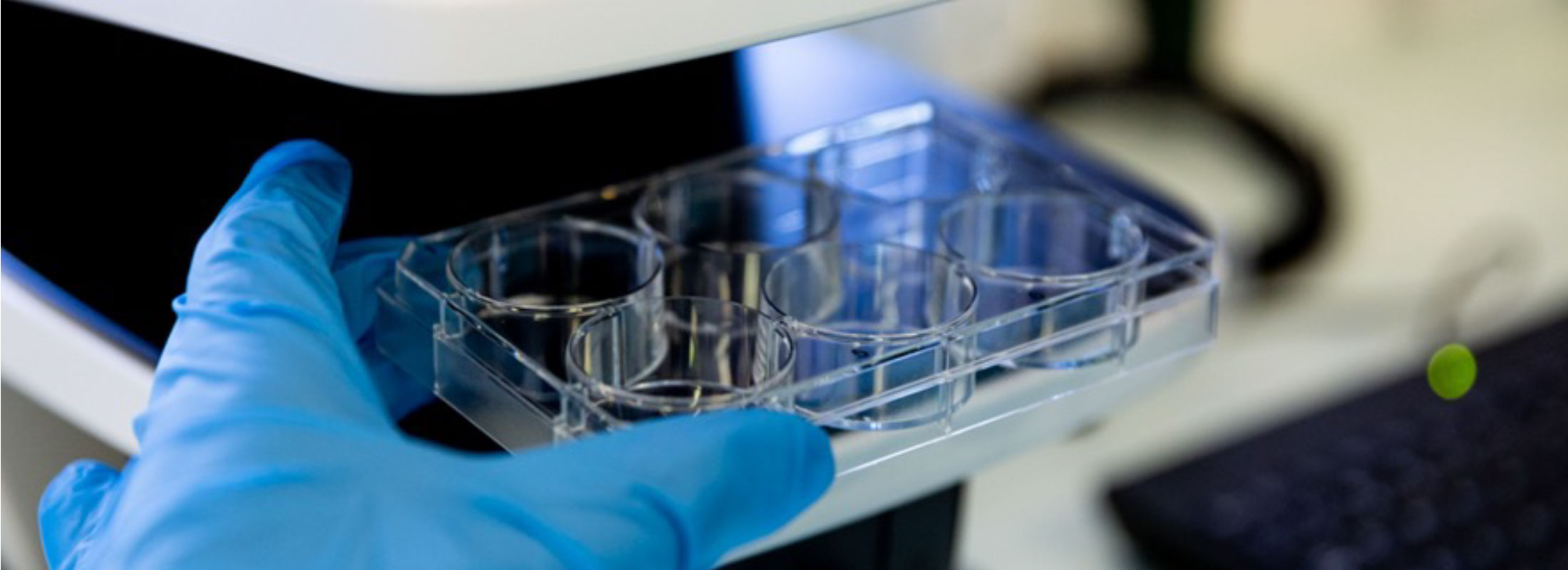Research in ICBR lab