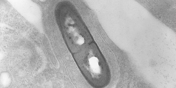 Listeria_monocytogenes_wikipedia commons