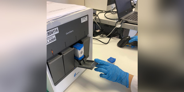 The GeneXpert testing platform for TB has been repurposed to test for Covid19