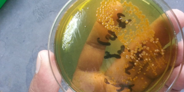 Flies and the hidden drivers of cholera